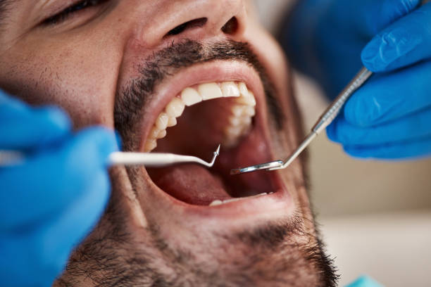 Professional Emergency Dentist in FL